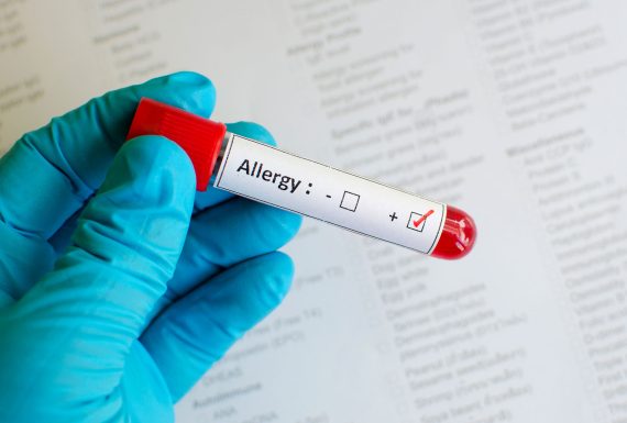 ALLERGOLOGY
